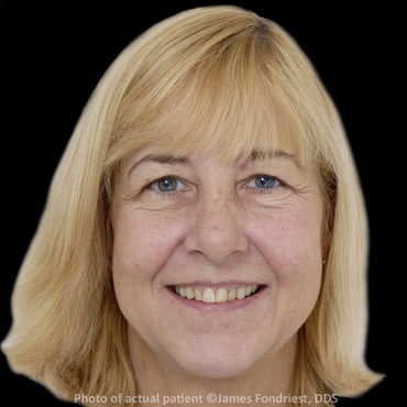 Glenview resident requesting white and bright straight teeth Glenview resident requesting white and bright straight teeth