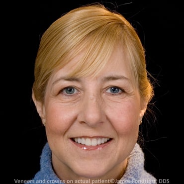 Correcting the length, shape and brightness of teeth Correcting the length, shape and brightness of teeth