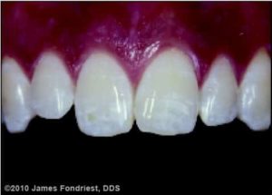 Fig 1 How easy would it be to describe these teeth in written form?