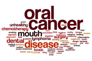 oral cancer exam at the dentist