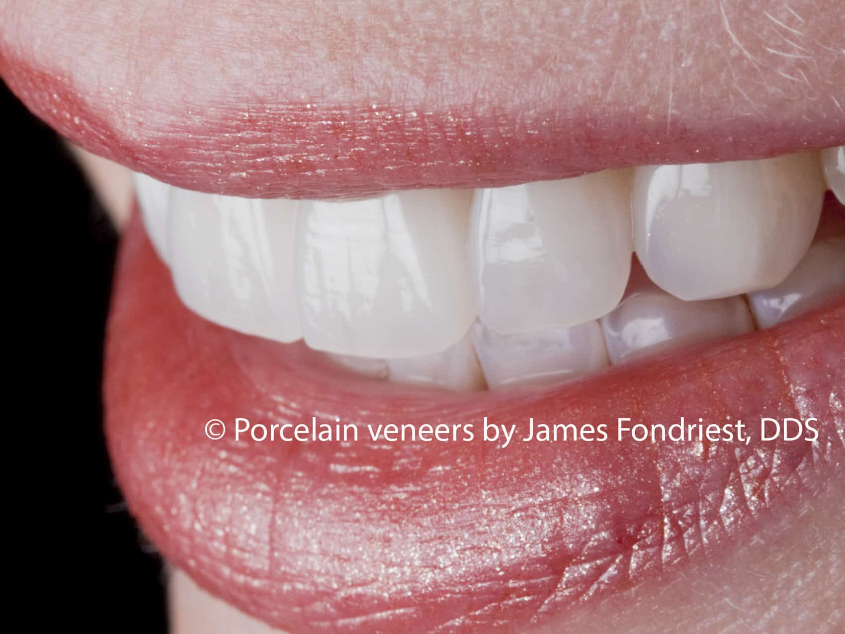 Natural looking dentistry James Fondriest, DDS, FACD, FICD