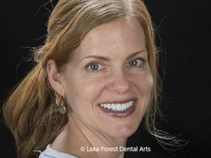 Cosmetic dentistry planning