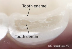 Tooth enamel