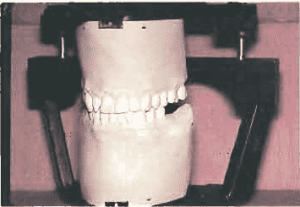 Figure 1. Mount study casts.