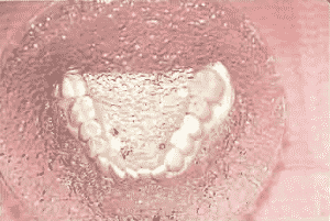 Figure 3. Suckdown template of diagnostic model.
