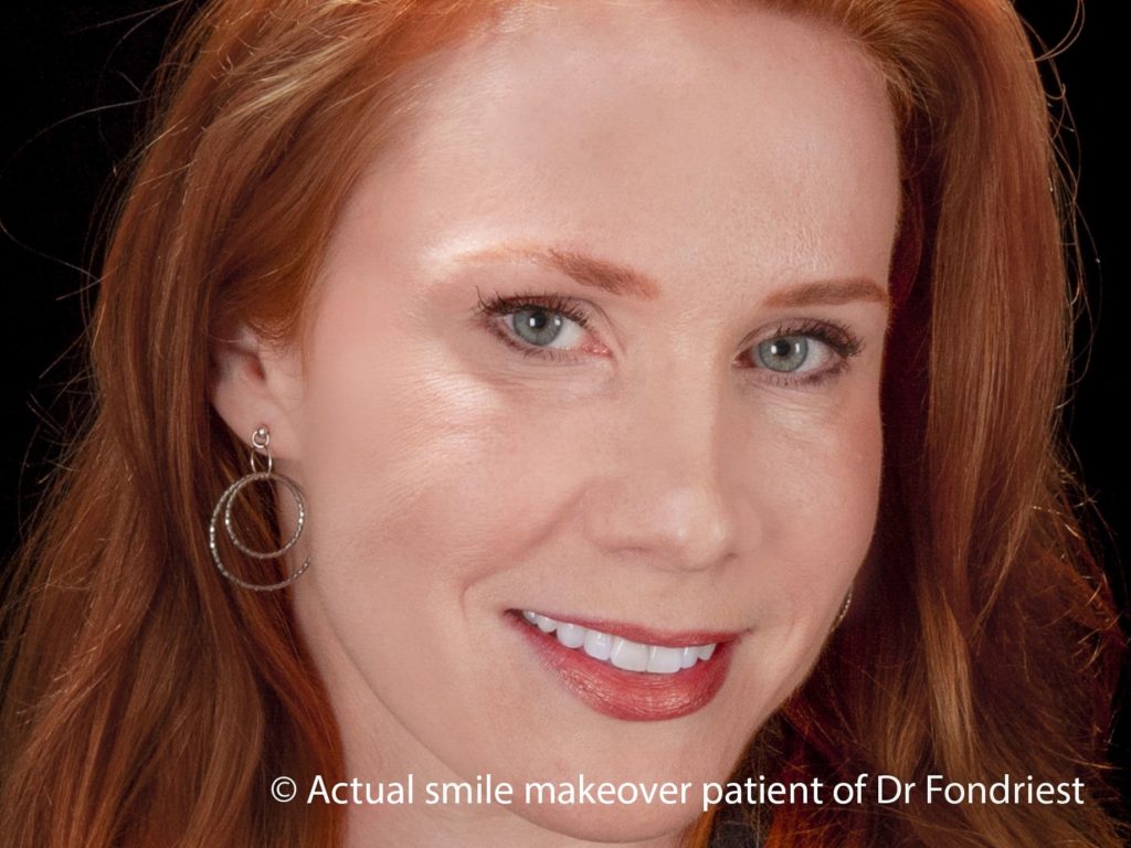 Cosmetic Dentistry Cosmetic Dentistry