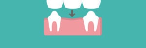 illustrated icon of dental bridge