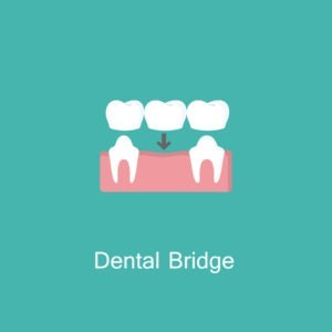 illustrated icon of dental bridge