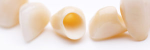 Zirconia crowns