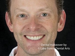Dentistry with less drilling