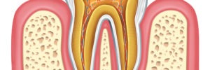 cavity repair gel in development