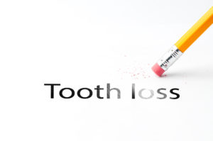 coping with tooth loss