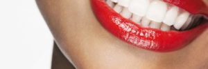 Is A Gum Lift Right For You?