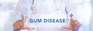 truth about gum disease