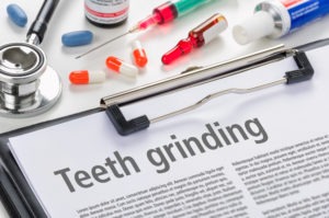 teeth grinding diagnosis paper on clipboard