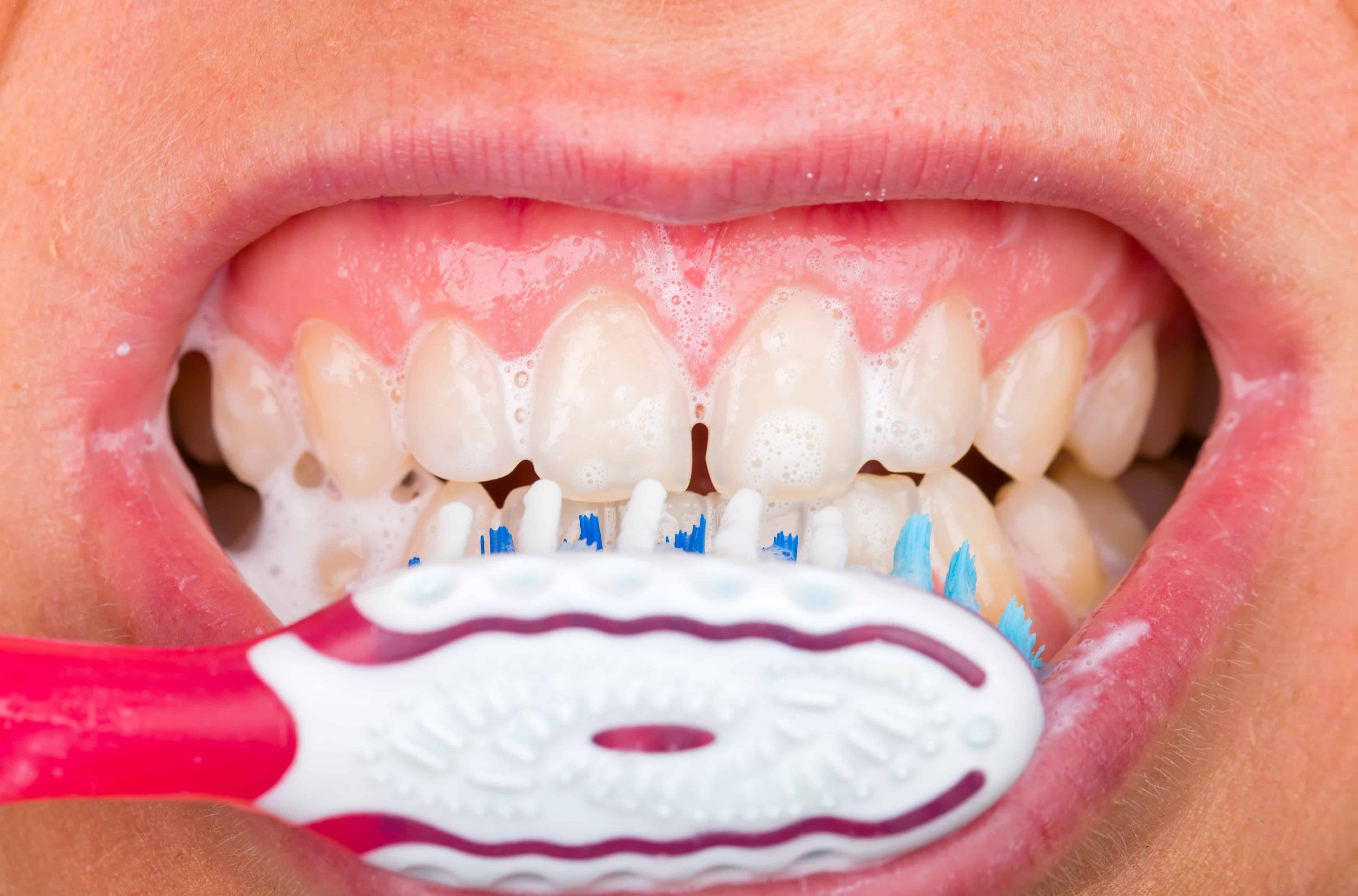 Emergency Vet Visit? Your Dog'S Gums Might Be Telling You Why - ugrc5z5