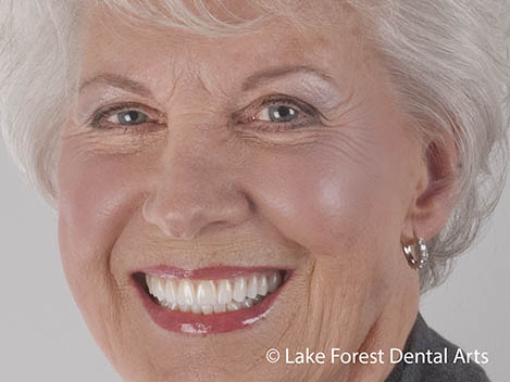 Looking for the best cosmetic dental treatments