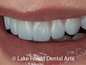 Before And After Photos Of Our Patients