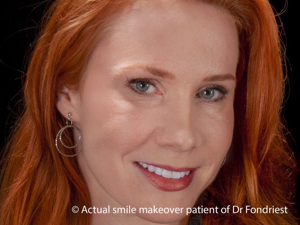 Cosmetic Dentist - Cosmetic Dentistry Cosmetic dentist - smile makeover
