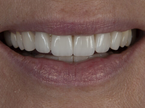 Cosmetic dentistry doesn't have to be ugly
