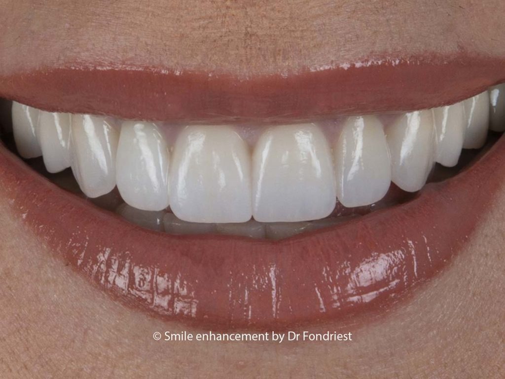 Not all Cosmetic dentistry is the same.