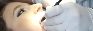 how to remove plaque from teeth
