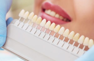 Choosing the color of your teeth