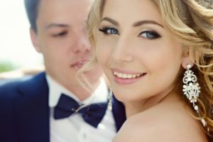 Composite veneers