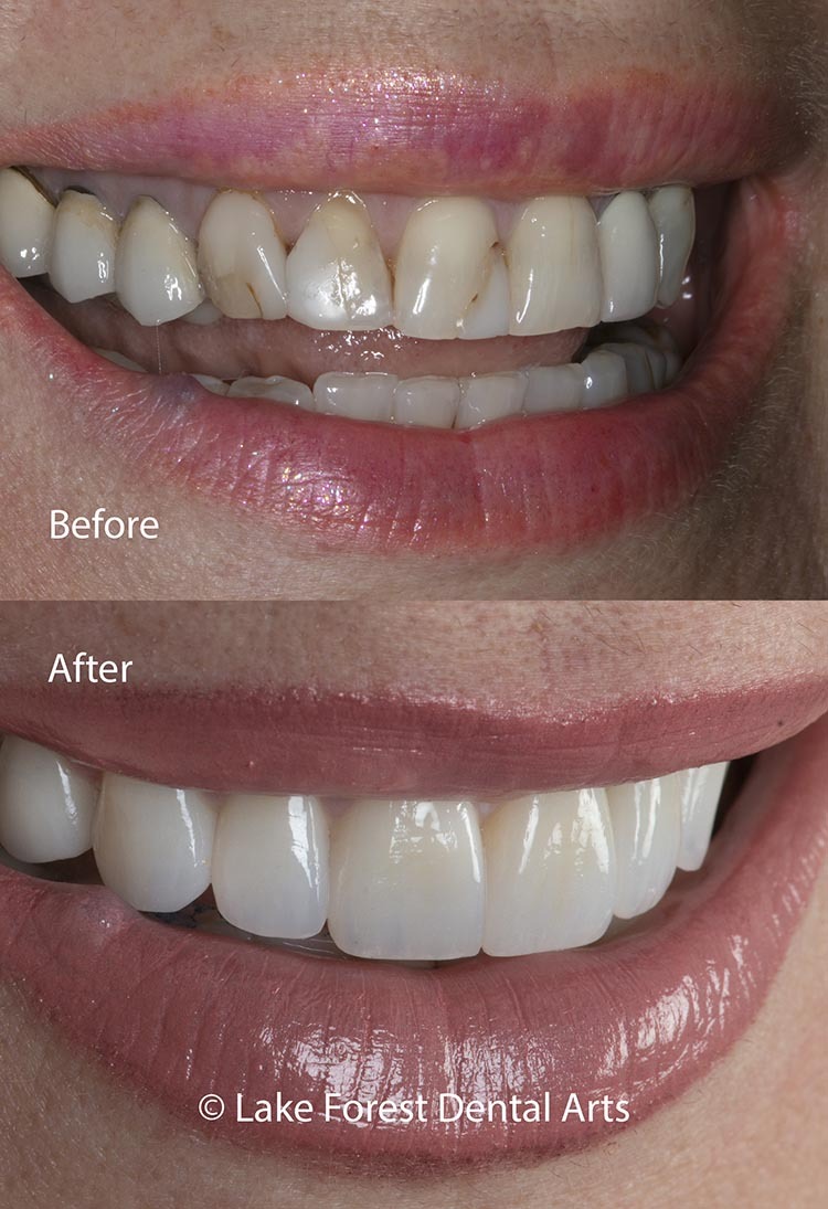 cosmetic dentistry pictures